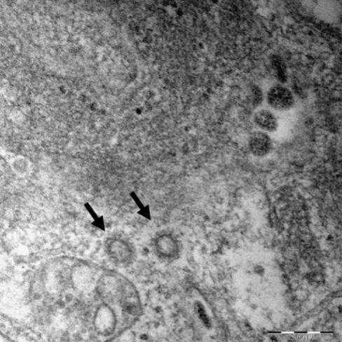 질병관리본부는 국내 코로나19 확진자 6명으로부터 얻은 바이러스 유전자의 고해상 전자현미경 사진을 지난달 27일 공개했다. (질병관리본부)